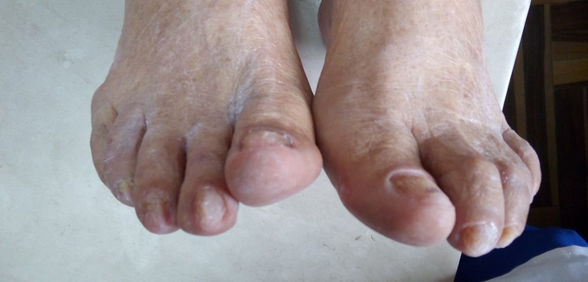 Pie sanos